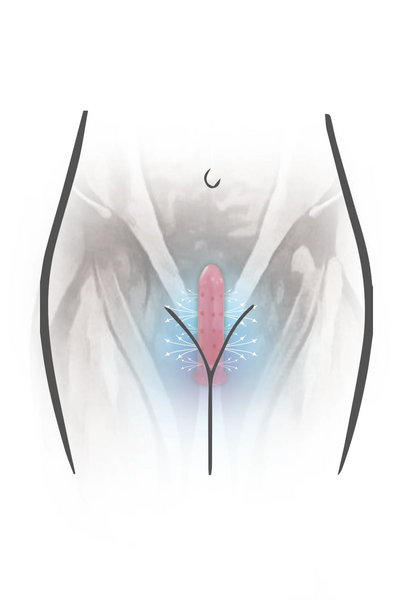 VuVa Neodymium Magnetic Vaginal Dilators Sizes 3,4,5,6