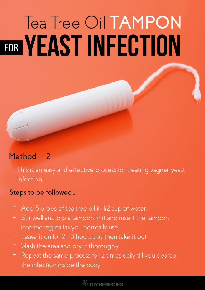 natural cure for yeast infection